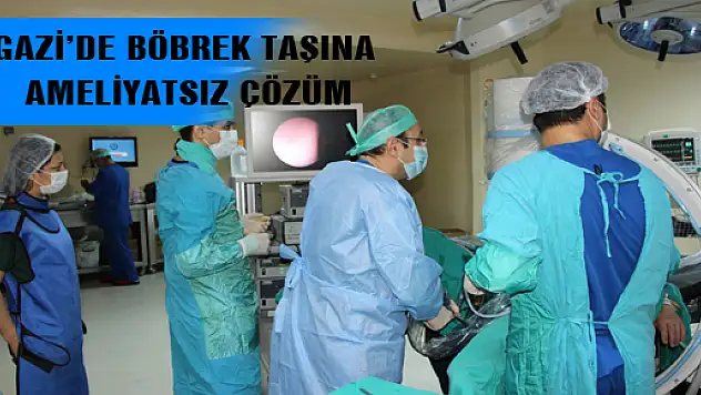 GAZİ'DE BÖBREK TAŞINA AMELİYATSIZ ÇÖZÜM