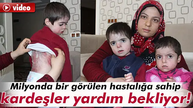 Doğuştan yaralılar