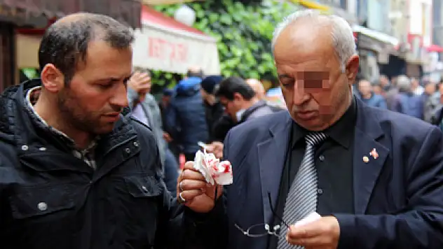 Yumruklu Saldırı: 1 Yaralı