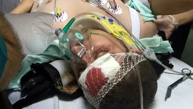  Samsun'da maganda kurşunu kameramana isabet etti