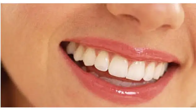 Yüzünüzün şekline göre gülüş tasarımı