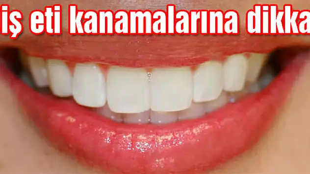 Diş eti kanamalarına dikkat