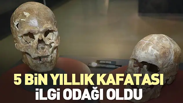 5 bin yıllık kafatası ilgi odağı oldu