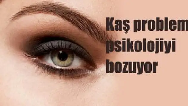 Kaş problemi psikolojiyi bozuyor