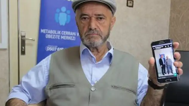 Tüp mide ameliyatı ile 49 kilo verdi