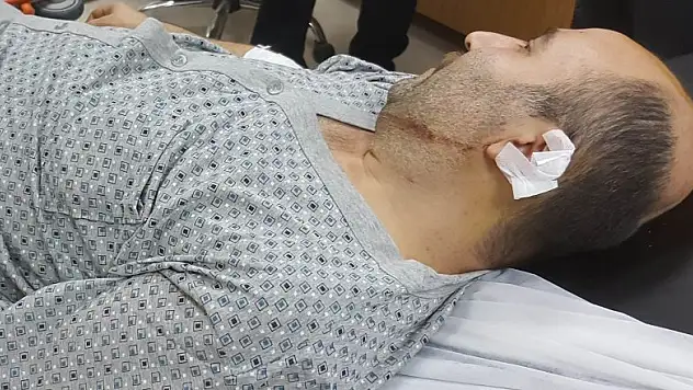 Silahlı saldırıda kazara vuruldu