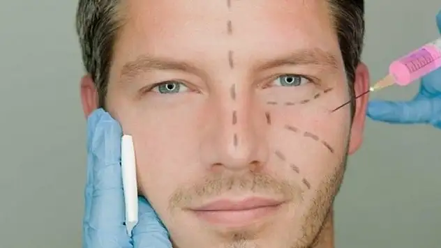 Erkekler burun estetiğinde daha titiz