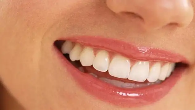 Diş rengi problemine dikkat