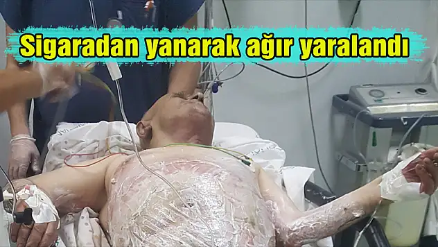 Sigaradan yanarak ağır yaralandı