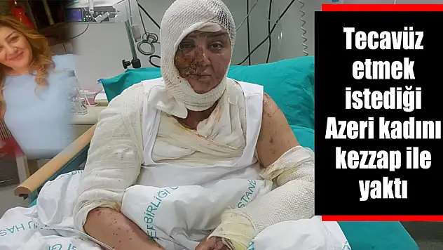 Tecavüz etmek istediği Azeri kadını kezzap ile yaktı 