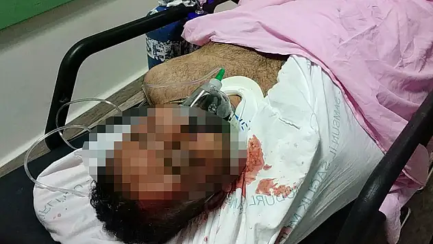  Samsun'da balkondan düşen Iraklı ağır yaralandı 