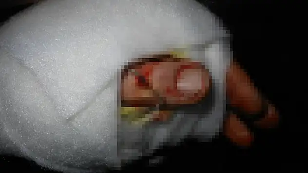 Parmak kopmasında ilk yapılması gerekenler 