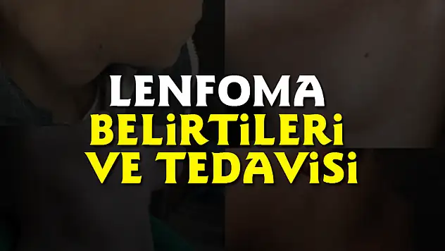 Lenfoma belirtileri ve tedavisi