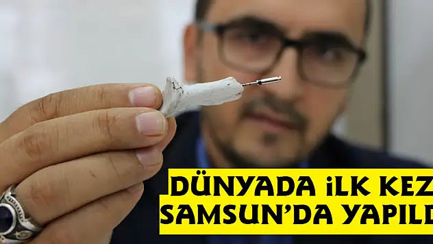 Dünyada ilk kez Samsun'da yapıldı
