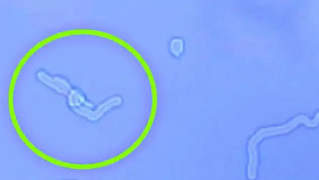 Gözünüzün önünde uçuşan sineklere dikkat