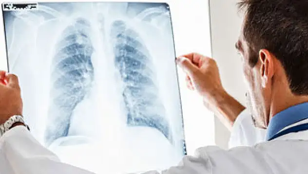 Akciğer kanserinde kemoterapi dönemi kapanıyor mu?