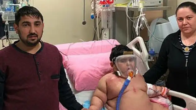 Yağız bebek 55 kiloya ulaştı