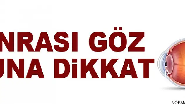 40 yaş sonrası göz tansiyonuna dikkat