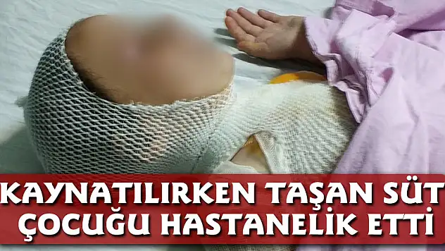 Kaynatılırken taşan süt çocuğu hastanelik etti