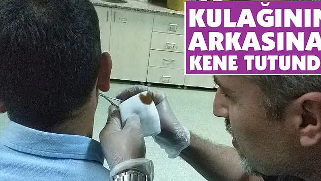 Kulağının arkasına kene tutundu