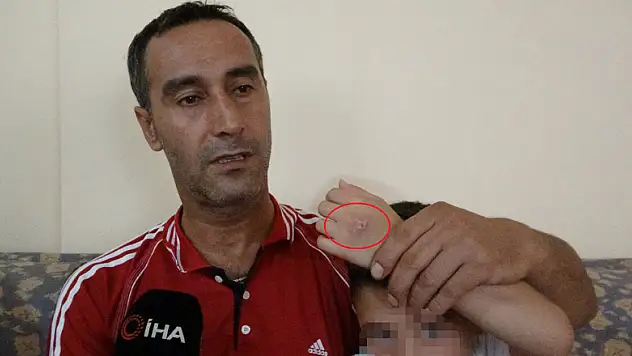 7 yaşındaki çocuğa ayrı yaşadığı annesi tarafından işkence iddiası 