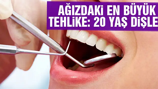 Ağızdaki en büyük tehlike: 20 yaş dişleri