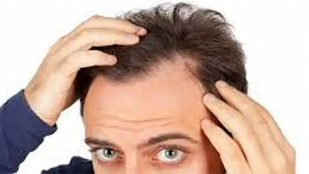 Saç ekimi cerrahisinde 7 yanılgıya dikkat