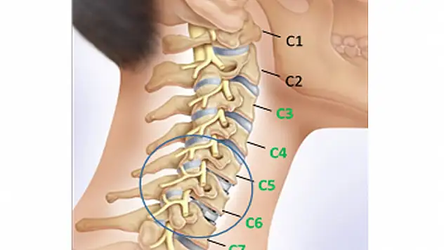 Boyun fıtığında cerrahi müdahale olmadan tedavi mümkün