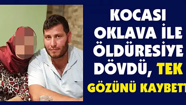 Kocası oklava ile öldüresiye dövdü, tek gözünü kaybetti