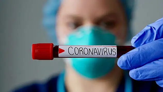 Dışişleri Bakan Yardımcısı Kıran: 'Covid -19 sebebiyle yurt dışında 156 vatandaşımızı kaybettik'