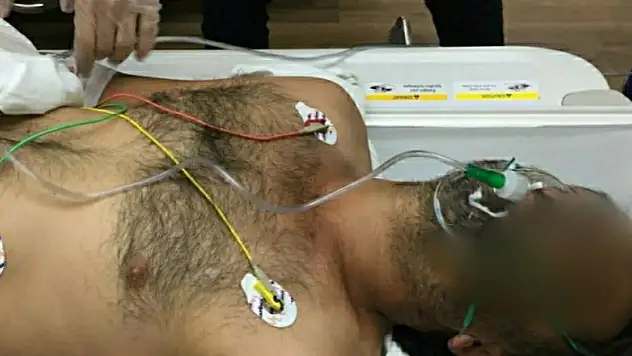 Havaya ateş ederken kendini ağır yaraladı