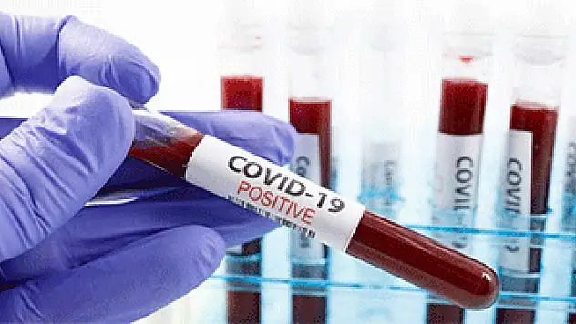 Almanya'da Kovid-19 testi skandalı