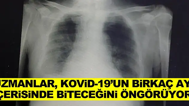 Uzmanlar, Kovid-19'un birkaç ay içerisinde biteceğini öngörüyor