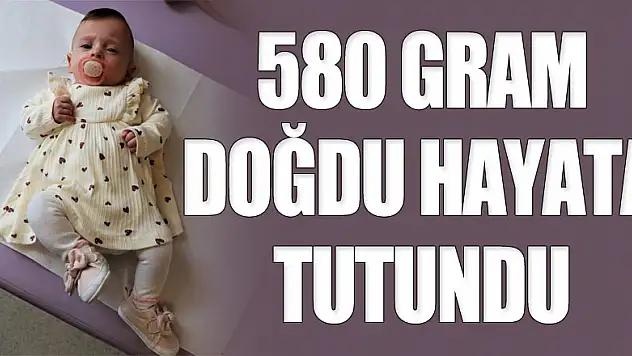 580 gram doğan Sude bebek hayata tutundu