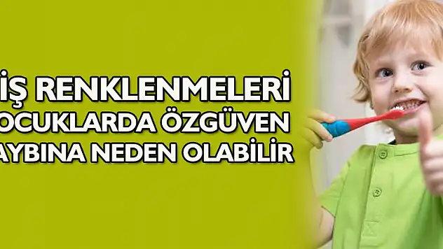 Diş renklenmeleri çocuklarda özgüven kaybına neden olabilir