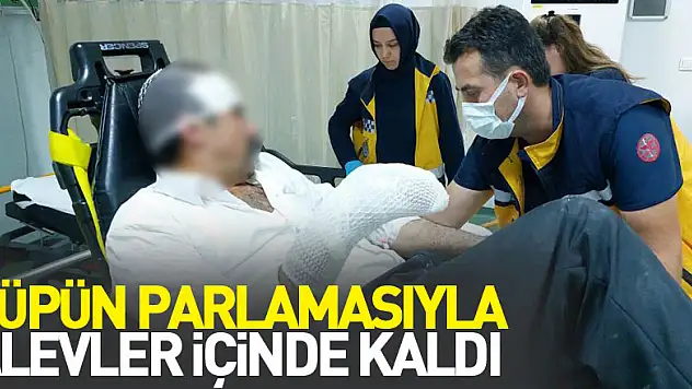 Samsun'da tüpün parlamasıyla alevler içinde kalan şahıs yaralandı