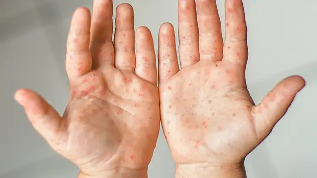 'Domates gribi olarak adlandırılmamalı'