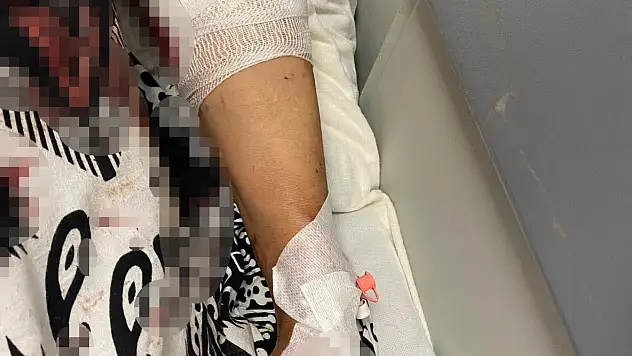 Bahçeye çıkan kadına köpekler saldırdı