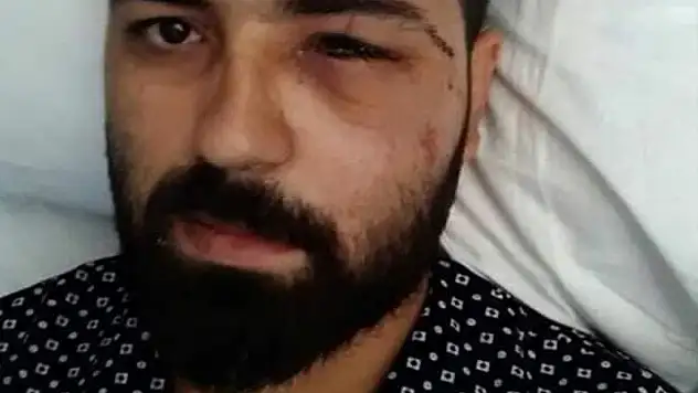 'Darbeci asker dalga geçer bir ses tonu ile 'sen kelime-i şehadet getir' dedi'