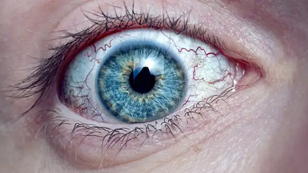 Görmede Bulanıklık Yaşanıyorsa Ne Zaman Doktora Başvurulmalı?