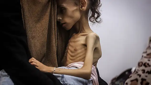 İsrail'in kıtlığa sürüklediği Gazze'de İnsanlık Dramı