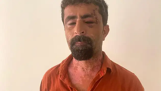 Öfkeli damat kayınpederini hastanelik etti