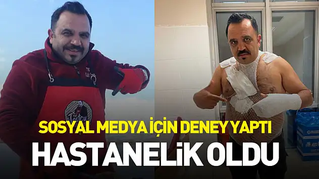 Sosyal medya için deney yaptı, hastanelik oldu