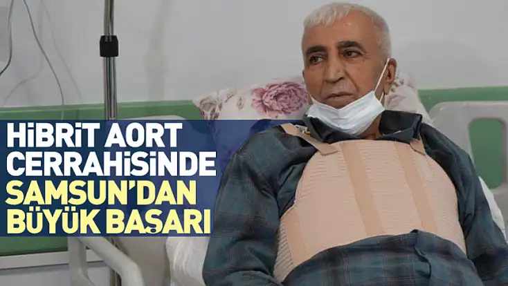 Hibrit Aort Cerrahisinde Samsun’dan Büyük Başarı