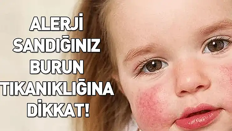 Alerji sandığınız burun tıkanıklığının nedeni kanser olabilir