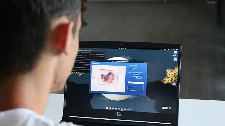 Lise öğrencisi geliştirdi, bir fotoğrafla cilt kanseri teşhis edilebilecek
