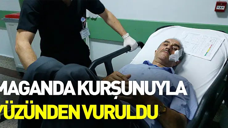 Nişan töreninde maganda kurşunuyla yüzünden vuruldu