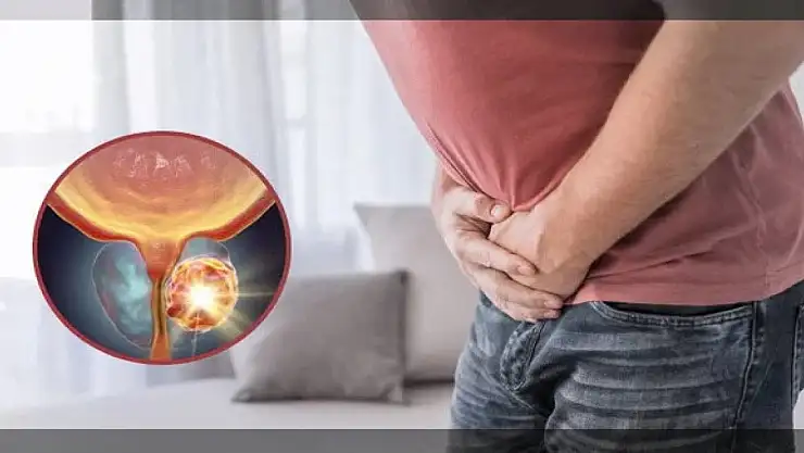 65 yaş üstündeki kişilerde prostat kanseri riski yüksek