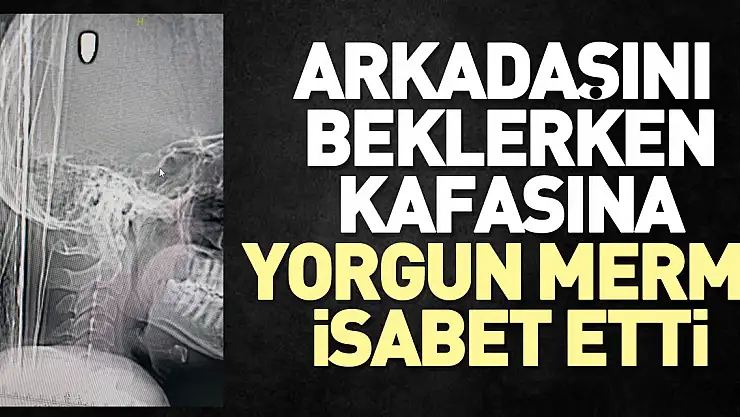 Arkadaşını beklerken kafasına yorgun mermi isabet etti