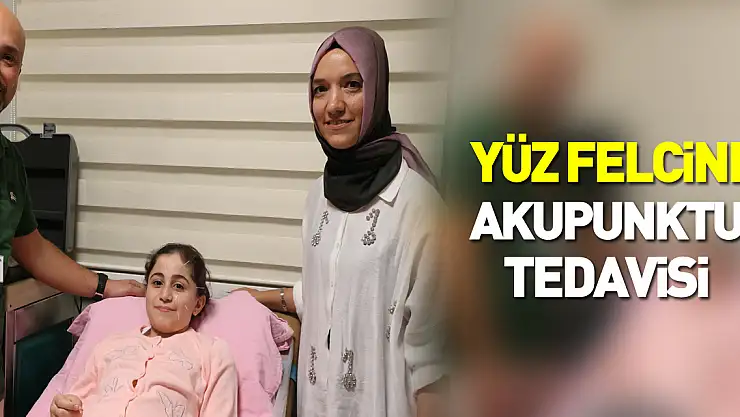 Yüz Felcine Akupunktur Tedavisi